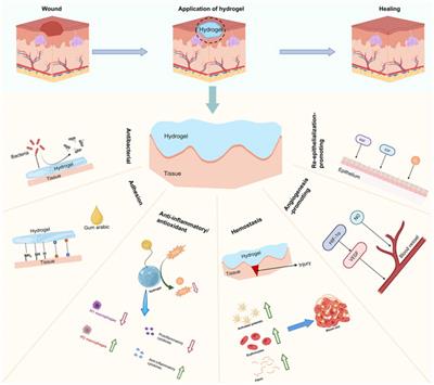 Editorial: Biomaterials for chronic wound healing